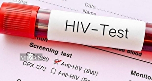 شناسایی نیمی از مبتلایان به ایدز در ایران/ درمان قطعی ایدز در راه است