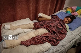 زندگی میان درد و ترس؛ کودکان غزه هزینه حملههای مداوم رژیم صهیونیستی را متحمل میشوند