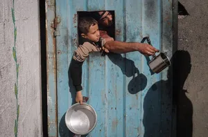 UNICEF: 9,300 children in the Gaza Strip suffer from severe malnutrition