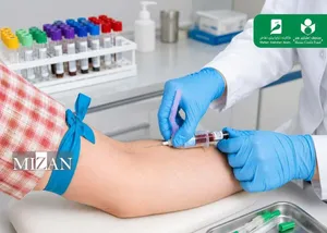 ارائه خدمات آزمایشگاهی در محل؛ برای هنرمندان عضو صندوق هنر در تهران و البرز