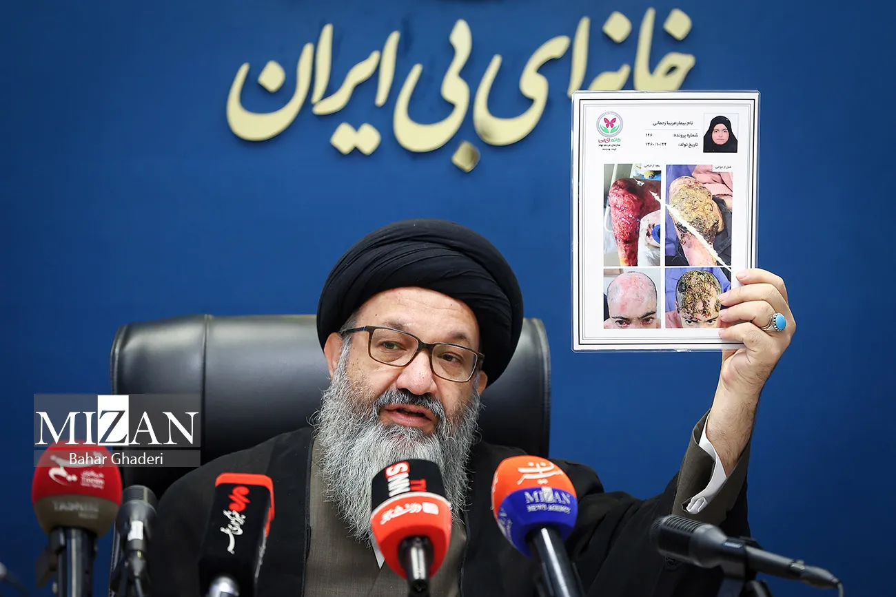 نشست خبری مدیرعامل انجمن بیماران پروانه‌ای
