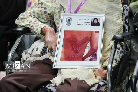 اینفوگرافیک | ۳۷ میلیون دلار نفت آمریکا در مسیر جبران خسارت بیماران پروانه‌ای