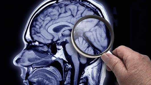 استخدام در اپل با چاپ 3 بعدی از تومور خود!