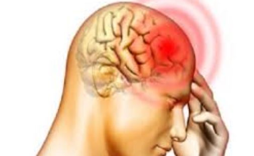 این سردردها مرگ آورند