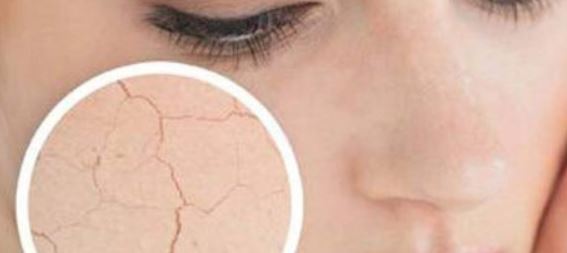 توصیه هایی برای زیبایی پوستتان / بهترین زمان برای بازسازی پوست را بشناسید توصیه هایی برای زیبایی پوستتان / بهترین زمان برای بازسازی پوست را بشناسید