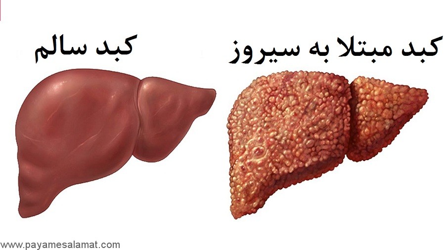 هشدار؛ ارتباط عجیب رانندگی با سرطان/ خطرات عینکهای آفتابی غیراستاندارد/ اهمیت توجه به وعده صبحانه در هرم غذایی هشدار؛ ارتباط عجیب رانندگی با سرطان/ خطرات عینکهای آفتابی غیراستاندارد/ اهمیت توجه به وعده صبحانه در هرم غذایی