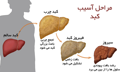 رعایت این نکات سلامت کبد شما را تضمین می کند
