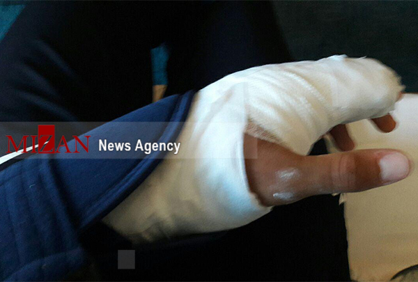 شکستگی انگشت مهاجم گسترش فولاد در دیدار با سیاه‌جامگان