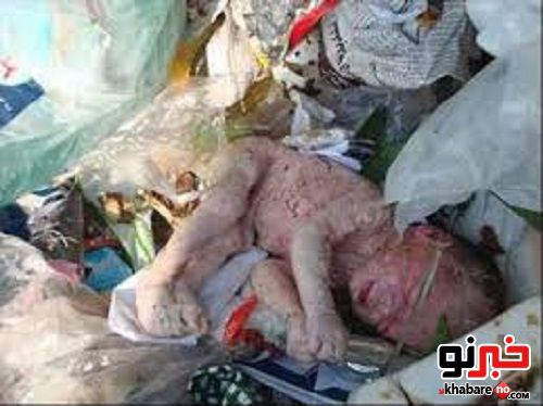 ماجرای واقعی پیدا شدن جنین در دانشگاه تهران + عکس