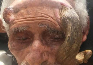 بریدن شاخ پیرمرد ۱۴۰ ساله موجب مرگش شد+عکس