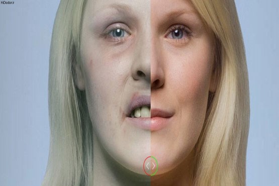 سیگار چه تاثیری بر پوست و چهره خواهد گذاشت؟