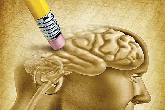 راهکارهای ساده برای پیشگیری از زوال عقل