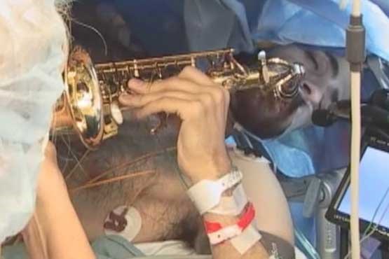 مغزش را جراحی می کردند، ساکسیفون می زد! +عکس مغزش را جراحی می کردند، ساکسیفون می زد! +عکس