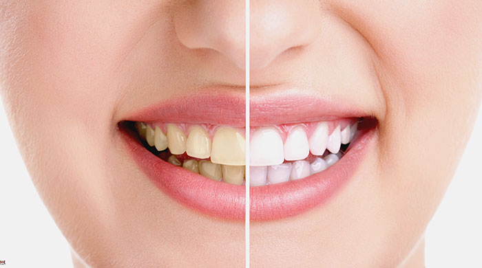 اعتماد به نفس خود را با توجه به سلامت دهان و دندان افزایش دهید اعتماد به نفس خود را با توجه به سلامت دهان و دندان افزایش دهید
