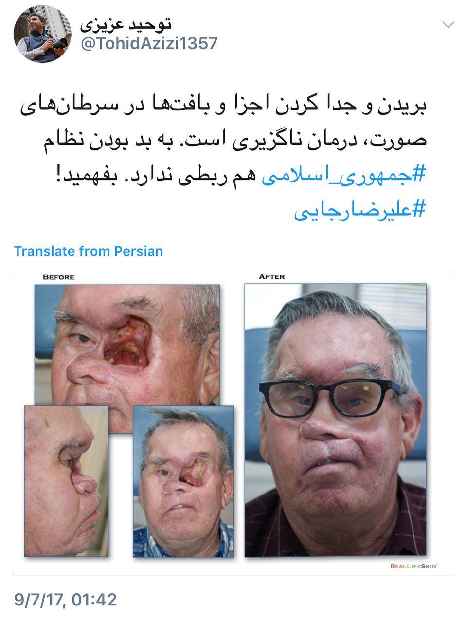 کاربر شبکه اجتماعی: جداکردن بافت‌ها در سرطان درمان ناگریزی است، به نظام جمهوری اسلامی هم ربطی ندارد