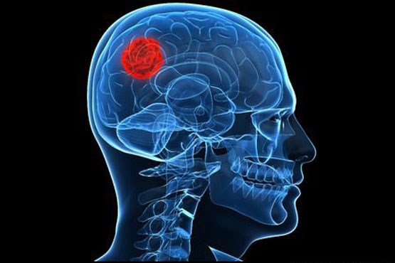 شگفت انگیزترین شیوه درمانی برای آنهایی که از آمپول میترسند! / وقتی حولهها کثیفتر از آن چیزی هستند که فکر میکنید/ خِس خِس سینه را جدی بگیرید شگفت انگیزترین شیوه درمانی برای آنهایی که از آمپول میترسند! / وقتی حولهها کثیفتر از آن چیزی هستند که فکر میکنید/ خِس خِس سینه را جدی بگیرید