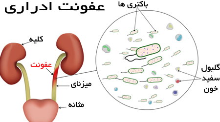 بیماری که همه زنان به آن مبتلا می شوند