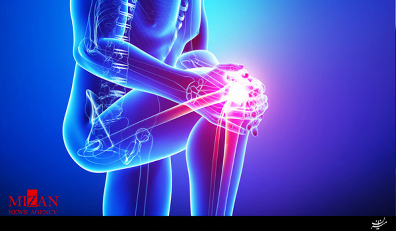 جامعه درگیر آرتروز است/شیوع بالای آرتریت روماتوئید در زنان