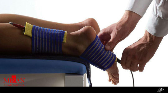 بیماری های«مثانه نوروژنیک»را بشناسیم/اهمیت درمان های الکتروتراپی