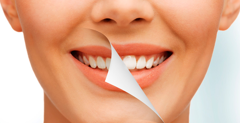 عوارض عمل زیبایی دندان چیست؟ عوارض عمل زیبایی دندان چیست؟