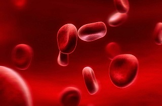 اگر این علائم را دارید دچار کم خونی شده‌اید