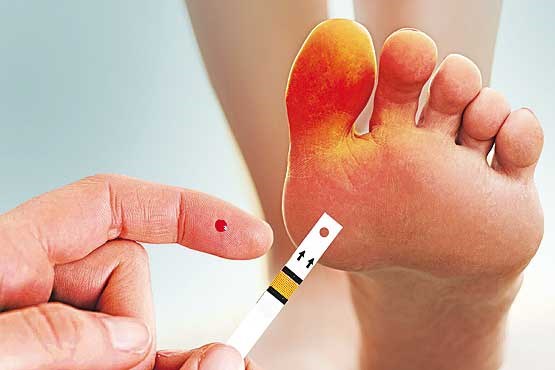 هر ۳ ثانیه یک نفر دیابتی و هر ۲۰ ثانیه یک عضو قطع می‌شود
