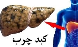 میزان کبد چرب در ایران بالاتر از میانگین جهانی است