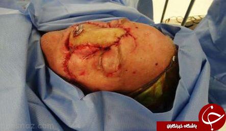 مردی که صورتش طعمه خرس وحشی شد+عکس مردی که صورتش طعمه خرس وحشی شد+عکس