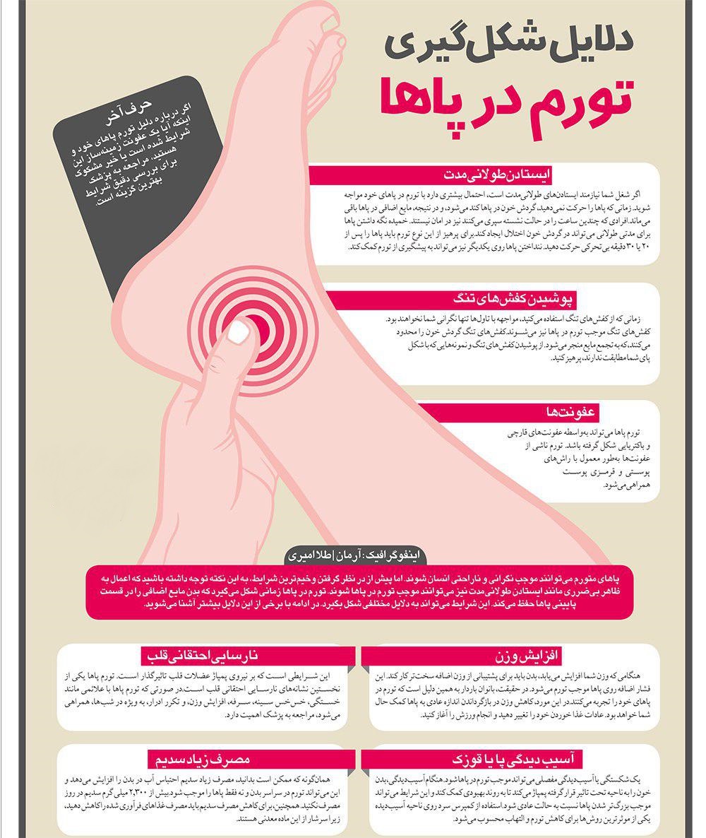 چرا پاها ورم می‌کنند؟+اینفوگرافی