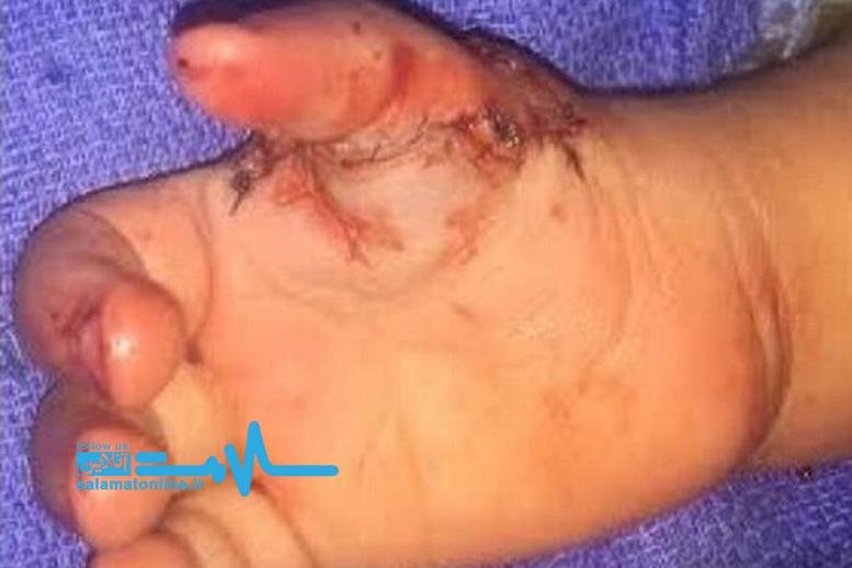 عمل جراحی شکفت آور رو دختر بچه ۲ ساله!+عکس عمل جراحی شکفت آور رو دختر بچه ۲ ساله!+عکس