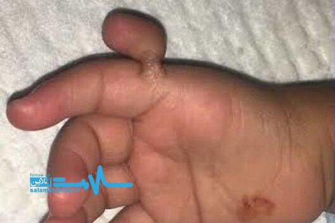 عمل جراحی شکفت آور رو دختر بچه ۲ ساله!+عکس عمل جراحی شکفت آور رو دختر بچه ۲ ساله!+عکس