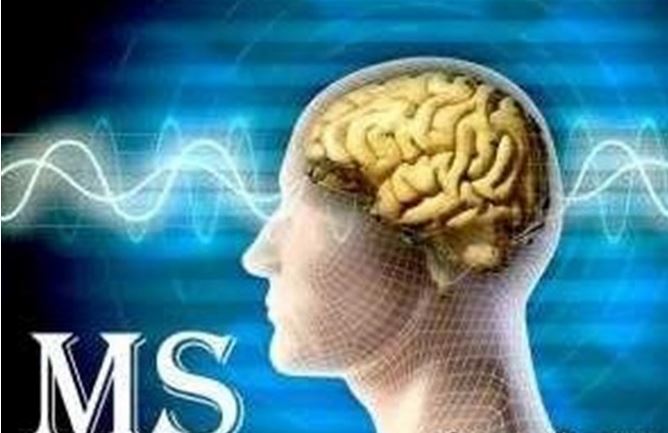 یک ایرانی راه درمان «ام اس» را پیدا کرد