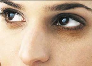 چرا دور چشم سیاه می شود؟