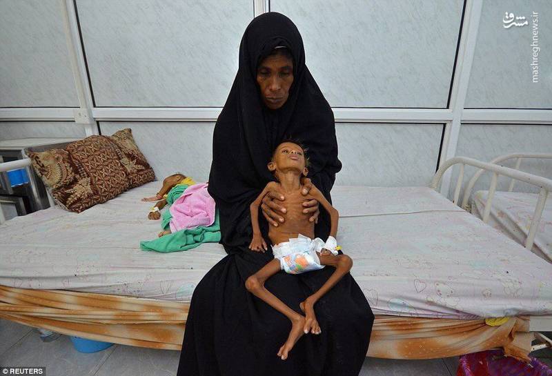 ۳۵ هزار کشته و زخمی و بیش از یک میلیون نفر به وبا مبتلا شدند +عکس ۳۵ هزار کشته و زخمی و بیش از یک میلیون نفر به وبا مبتلا شدند +عکس