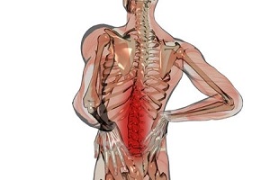 عامل ایجاد عارضه تنگی کانال نخاعی چیست؟