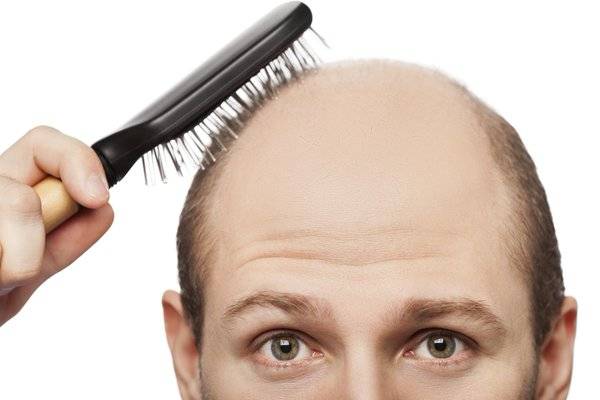 ۷ ماده غذایی برای افزایش رشد مو