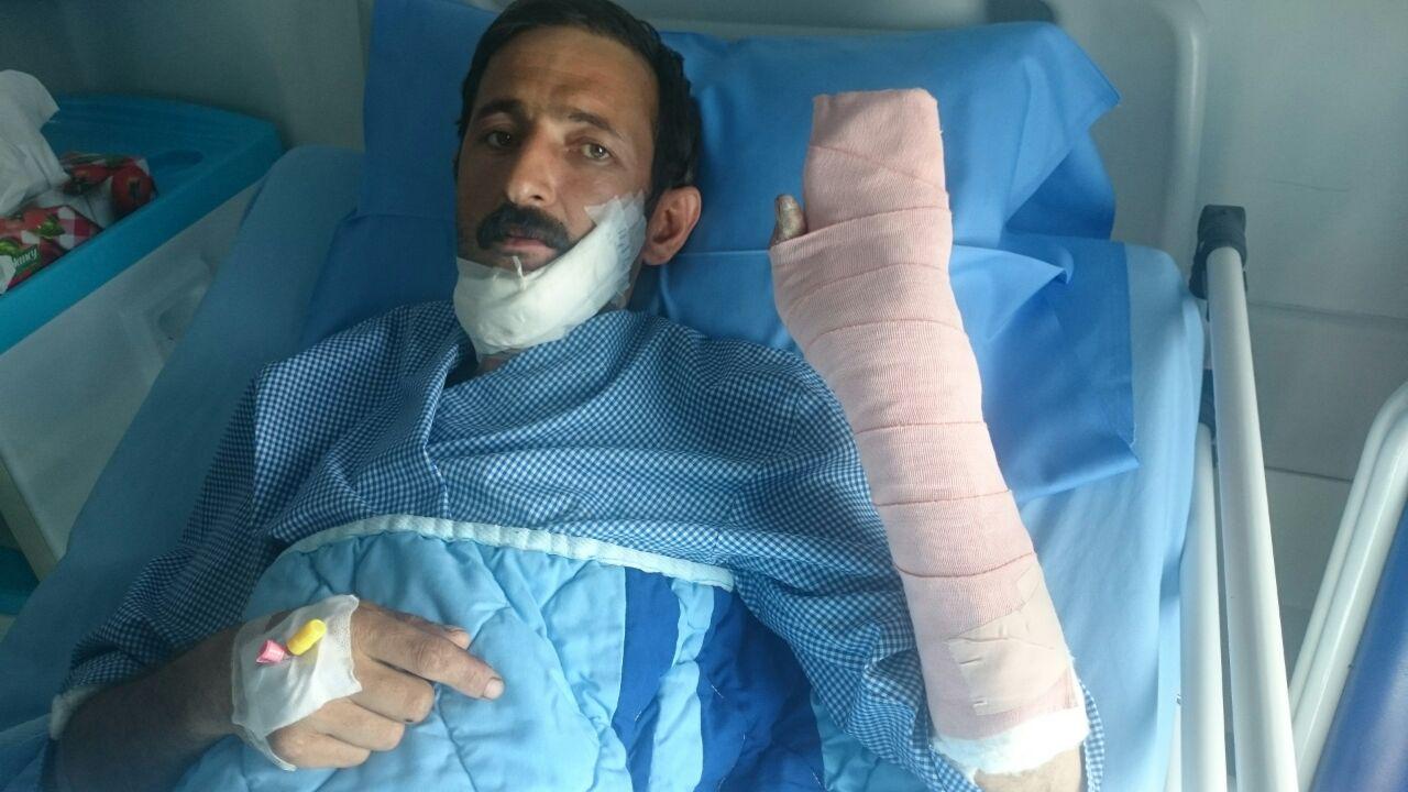 فک،زبان و دست قطع شده مصدوم ۳۹ ساله در البرز پیوند خورد فک،زبان و دست قطع شده مصدوم ۳۹ ساله در البرز پیوند خورد