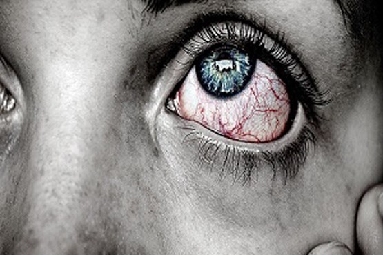 آنچه ترشحات چشم درباره سلامت شما فاش می‌کند