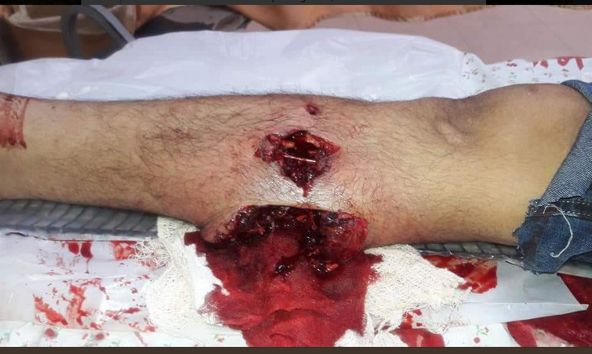 نوار غزه آزمایشگاه سلاحهای اسرائیل؛ از گلوله‌های پروانه‌ای تا گازهای سمی تشنج‌آور
