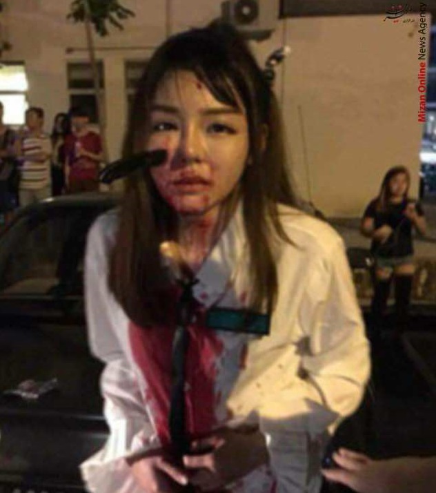 جاماندن چاقو در صورت یک نوجوان