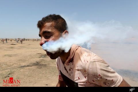 شلیک مستقیم گاز اشک آور صهیونیستها به صورت جوان فلسطینی + تصاویر شلیک مستقیم گاز اشک آور صهیونیستها به صورت جوان فلسطینی + تصاویر