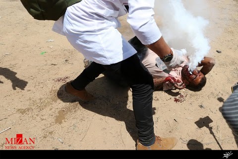 شلیک مستقیم گاز اشک آور صهیونیستها به صورت جوان فلسطینی + تصاویر شلیک مستقیم گاز اشک آور صهیونیستها به صورت جوان فلسطینی + تصاویر