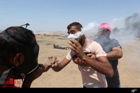 شلیک مستقیم گاز اشک آور صهیونیستها به صورت جوان فلسطینی + تصاویر شلیک مستقیم گاز اشک آور صهیونیستها به صورت جوان فلسطینی + تصاویر