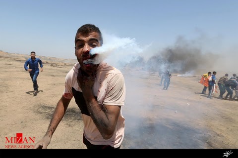 شلیک مستقیم گاز اشک آور صهیونیستها به صورت جوان فلسطینی + تصاویر شلیک مستقیم گاز اشک آور صهیونیستها به صورت جوان فلسطینی + تصاویر