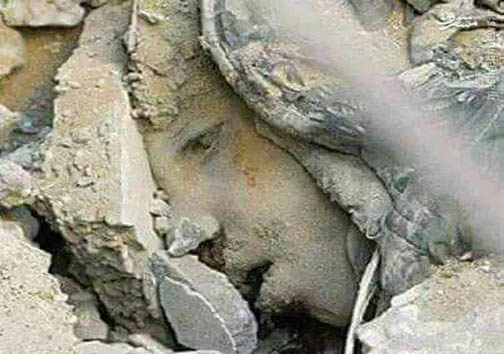 عکس؛ کودکی که زیر بمباران سعودیها، دفن شد عکس؛ کودکی که زیر بمباران سعودیها، دفن شد
