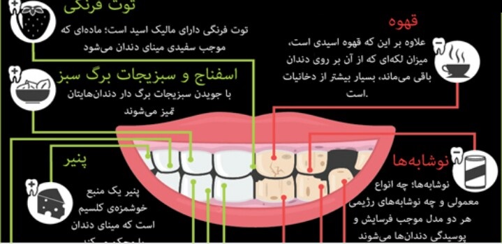 مواد غذایی که دندانهای شما را نابود میکنند! +اینفوگرافی مواد غذایی که دندانهای شما را نابود میکنند! +اینفوگرافی