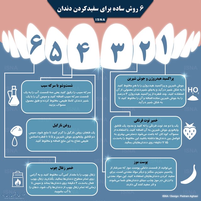 روشهای کاربردی برای سفید کردن دندان +اینفوگرافی روشهای کاربردی برای سفید کردن دندان +اینفوگرافی