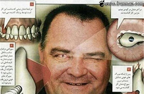 پیوند عجیب و باورنکردنی دندان به جای چشم +عکس