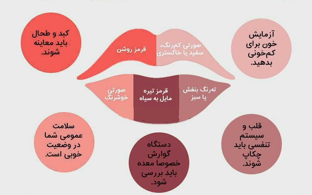 آیا میدانید؛ رنگ لب ها از سلامتی شما خبر می دهد؟! +اینفوگرافی آیا میدانید؛ رنگ لب ها از سلامتی شما خبر می دهد؟! +اینفوگرافی