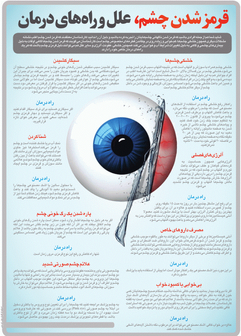 قرمز شدن چشم؛ علل و راه های درمان +اینفوگرافی قرمز شدن چشم؛ علل و راه های درمان +اینفوگرافی